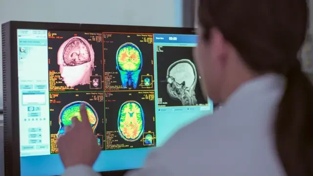 Uma médica observa o monitor de um aparelho de ressonância magnética; a tela exibe cinco diferentes imagens do cérebro.